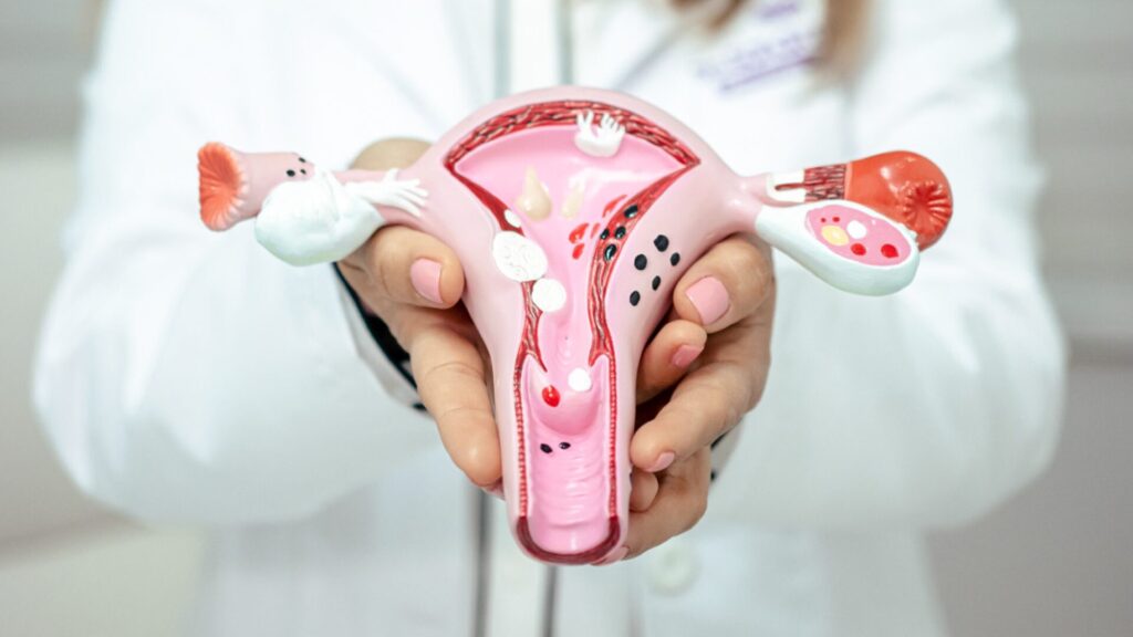 Ginecologia y Obstetricia