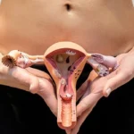 Infecciones vaginales a repetición o seguidas